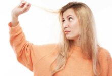 راههای رهایی از چربی موها